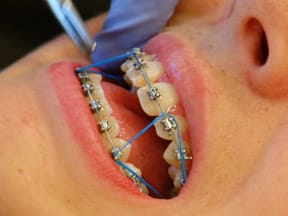 Elastics in Johns Creek